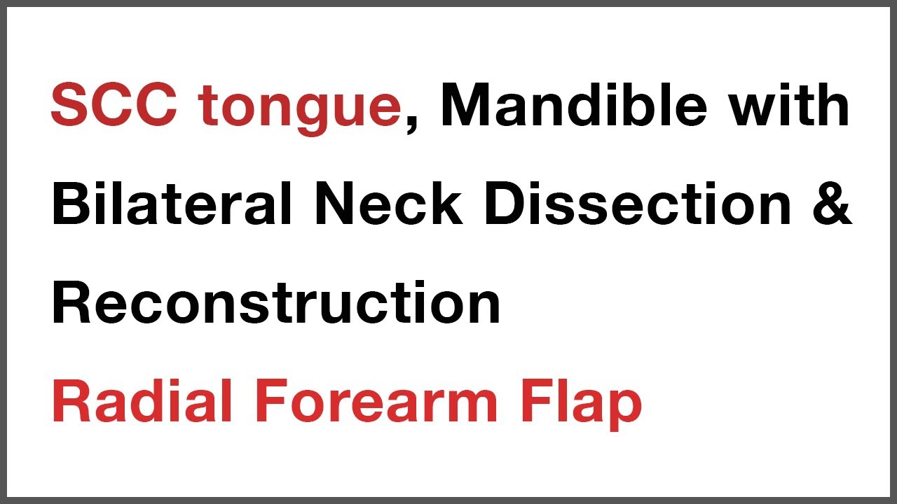 SCC tongue, Mandible with Bilateral Neck Dissection & Reconstruction Radial Forearm Flap